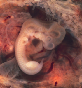 Embryo at seven weeks.