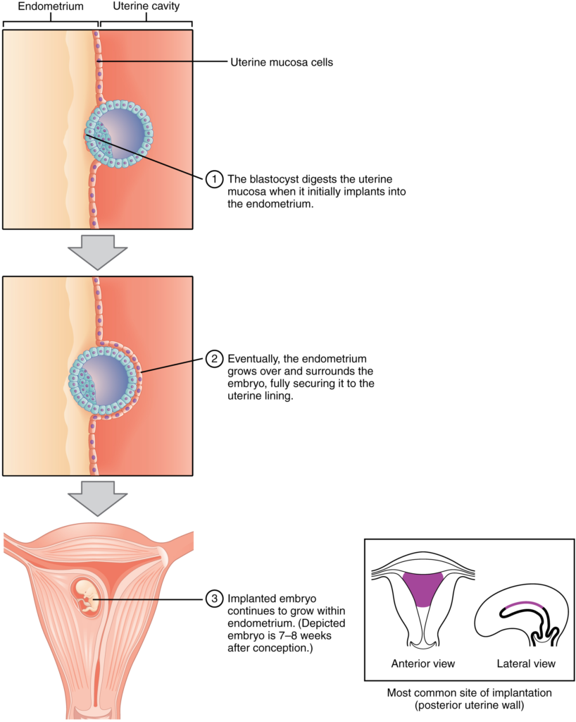 Diagram of implantation
